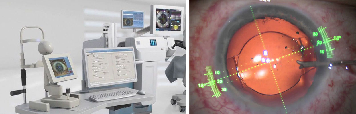 Verion Image Guided System