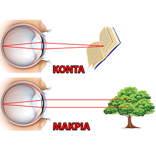 Διόρθωση της πρεσβυωπίας με μέθοδο Monovision