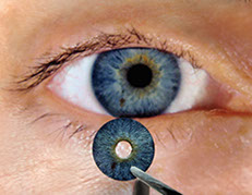 Τεχνητή ίριδα